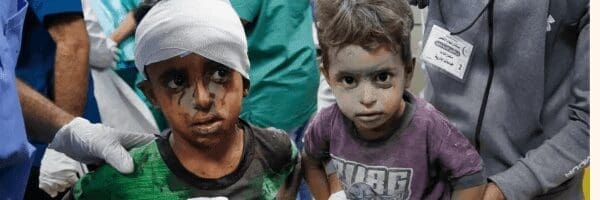 Palestinian children injured during the war in Gaza