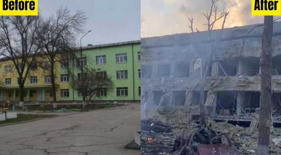 Chikdren’s hospital bombed in Ukraine war